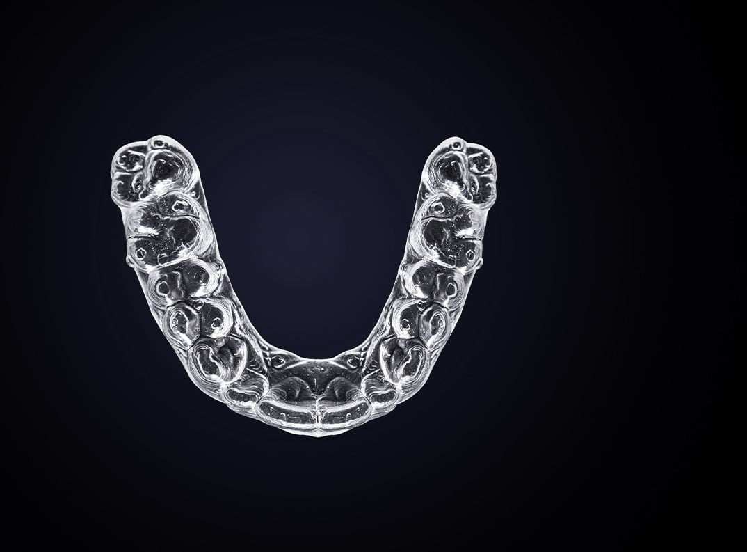 clear aligners